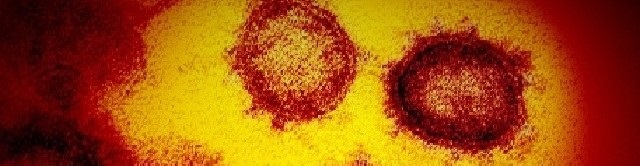 新型コロナウイルス倒産情報
